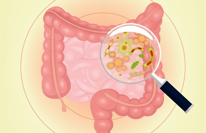 濕疹 中醫,腸胃,濕重,精神壓力,濕疹成因