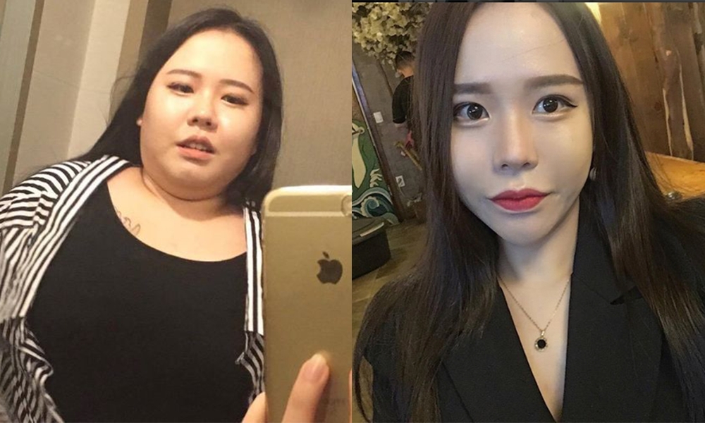 韓國女生告別「矮肥短」 混合飲食法半年減肥減走66磅