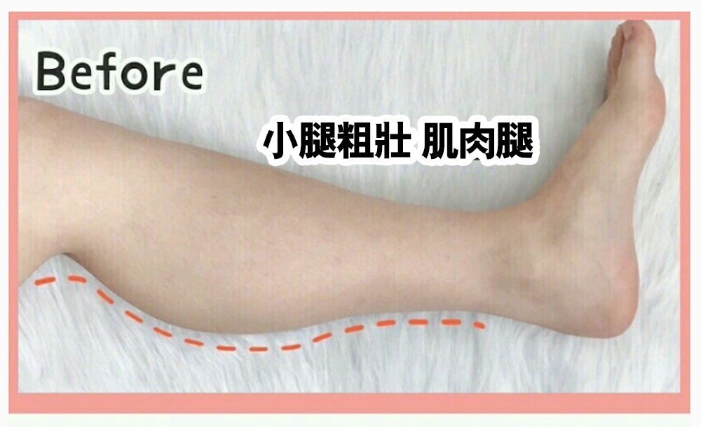 修腿按摩 懶人睡前塑腿按摩,浮腫,肌肉,粗壯,血液循環,消水腫,拉伸,潤膚露,塑形