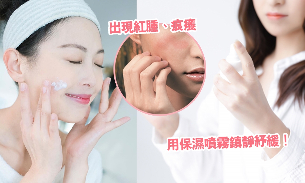 面部皮膚敏感｜急救處理止痕方法+敏感成因！舒緩敏感紅腫