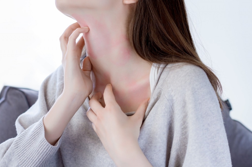 濕敏 皮膚情況可嚴重到出現紅﹑痕﹑乾，甩皮或感染。