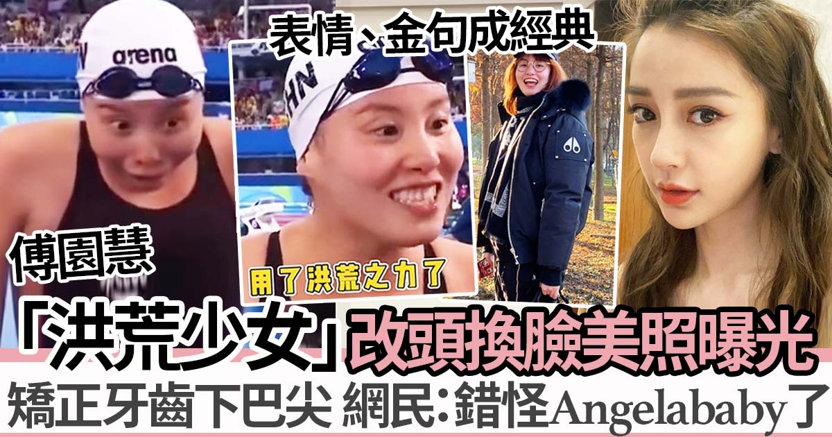 中國退役女泳手傅園慧牙齒矯正後 180度換臉！網民：錯怪Angelababy了