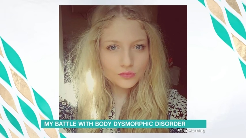英國少女14歲患奇怪心理病 