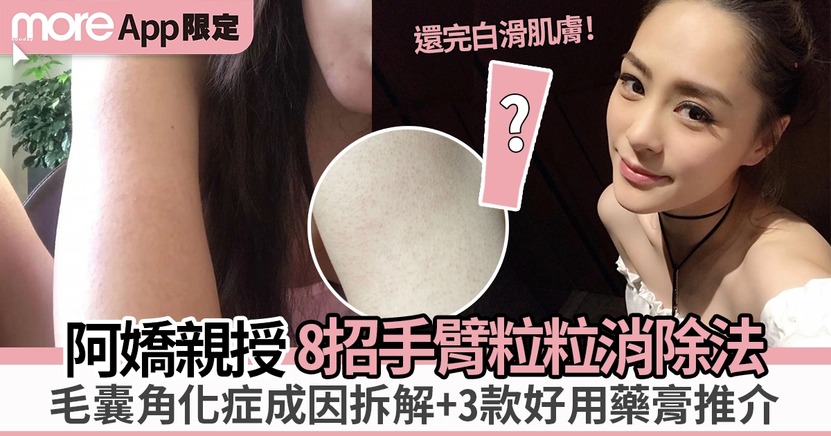 手臂粒粒