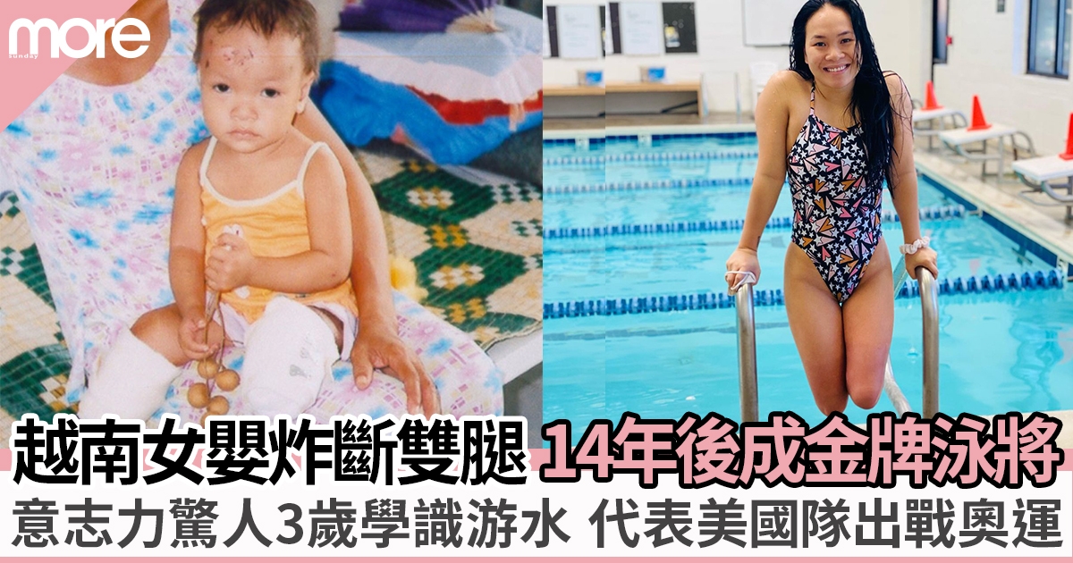 越南女嬰被父親炸斷雙腿 獲美國夫婦好心收養 14年後成金牌游泳運動員！