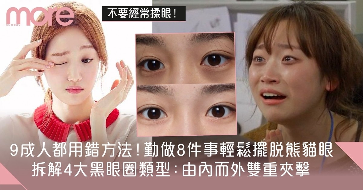 去黑眼圈8大有效消除方法｜4種類型成因拆解 不靠遮瑕由內至外改善眼紋眼圈