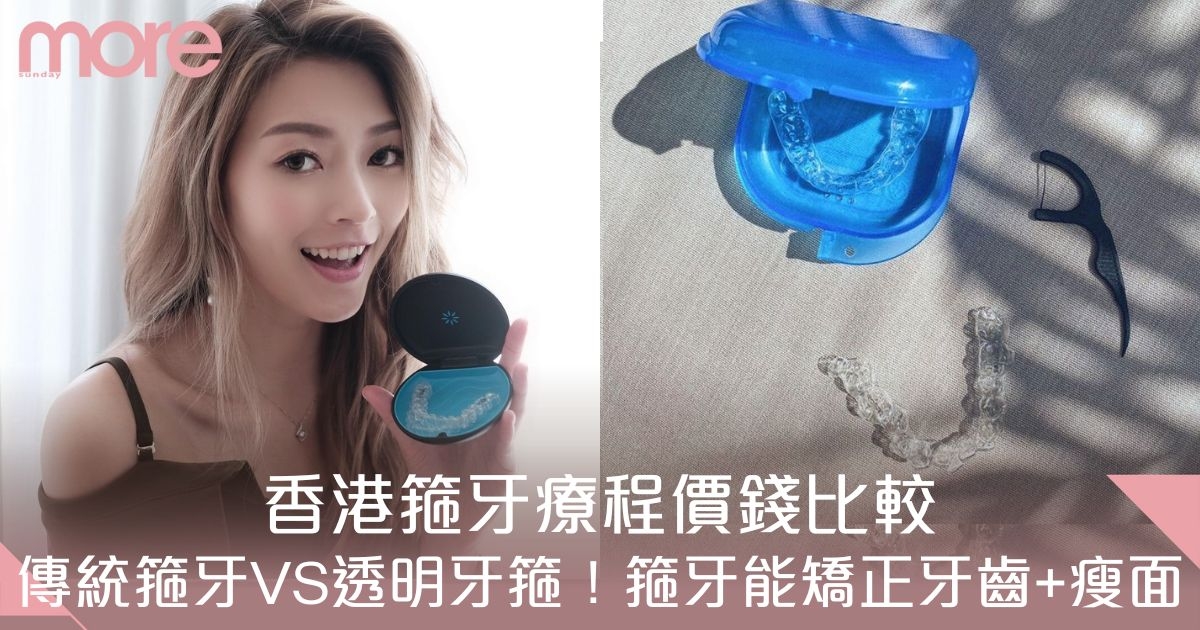 香港箍牙價錢2025｜隱形牙箍療程價錢比較！矯正牙齒+改善臉型變更美