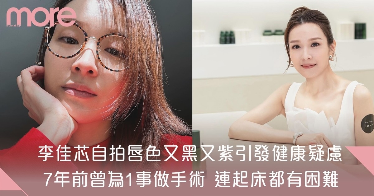 李佳芯自拍唇色又黑又紫引發健康疑慮 7年前曾為1事做手術