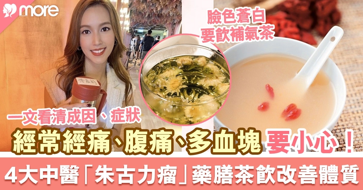 中醫：經痛、腹痛或患朱古力瘤！一文看清朱古力瘤成因/症狀/4款調理茶飲