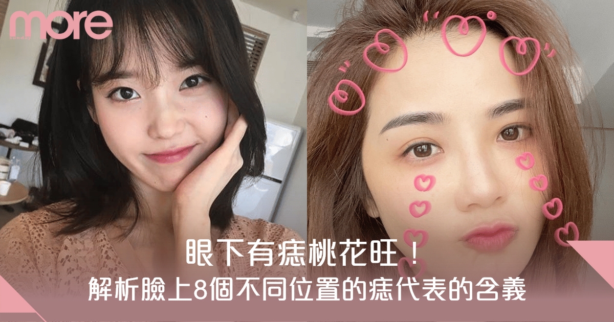 痣