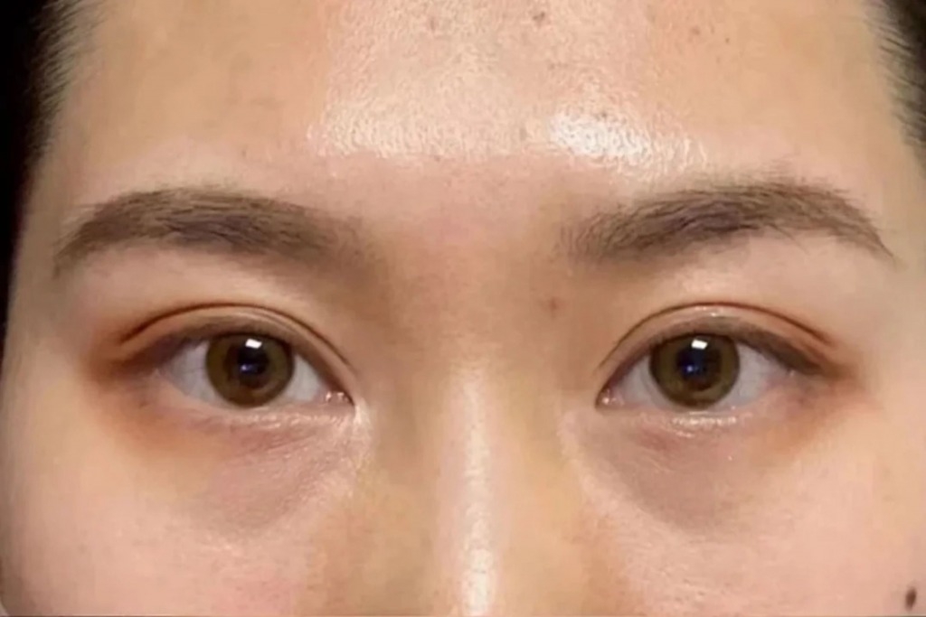 熊貓眼 (圖片來源:RED@不吃香菜)