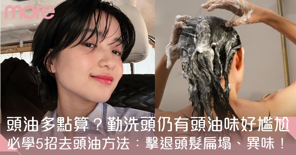 頭油多怎麼辦？勤洗頭仍然有頭油味？5個去頭油方法：擊退頭髮扁塌、異味