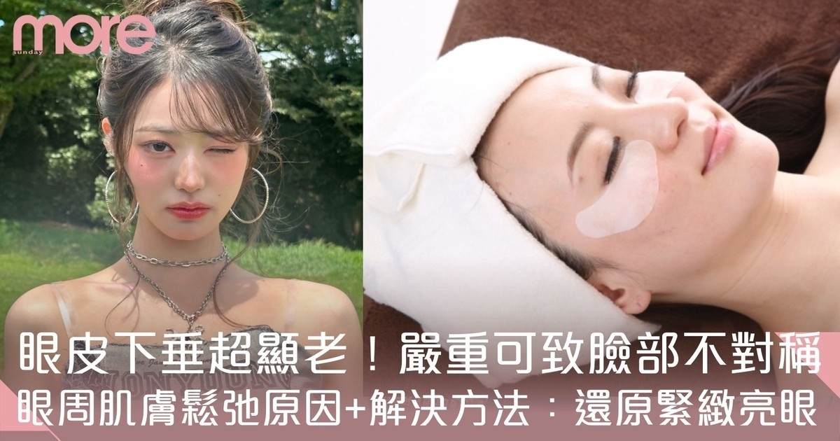 眼皮下垂原因+解決方法：眼周肌膚鬆弛超顯老！處理不當會令臉部不對稱！