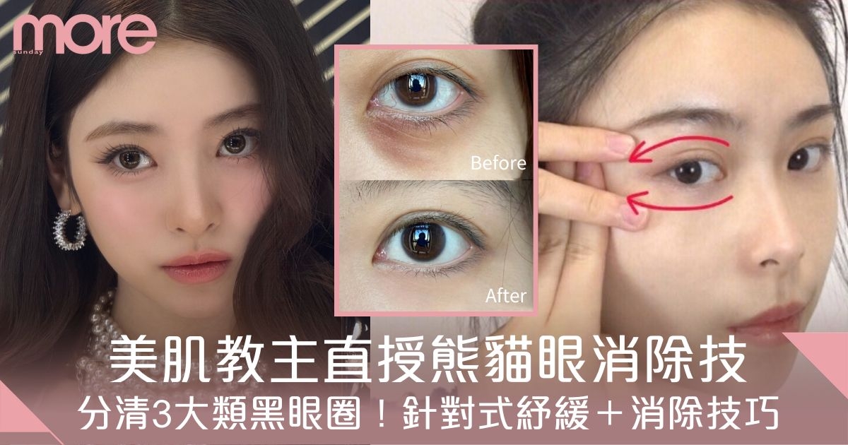 美肌教主直授熊貓眼消除技巧！針對3大類黑眼圈＋紓緩消除法