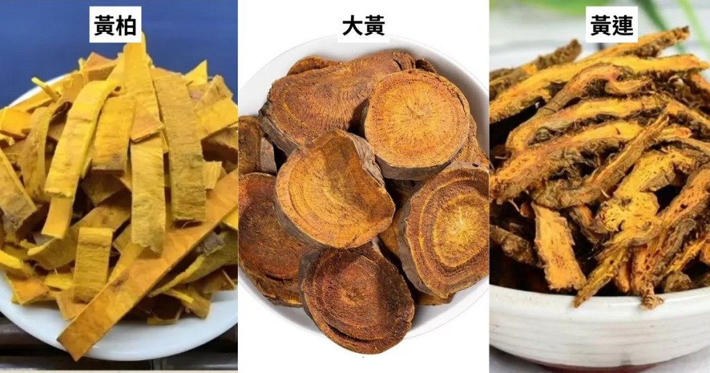 頭皮癬 (圖片來源:MORE製圖)