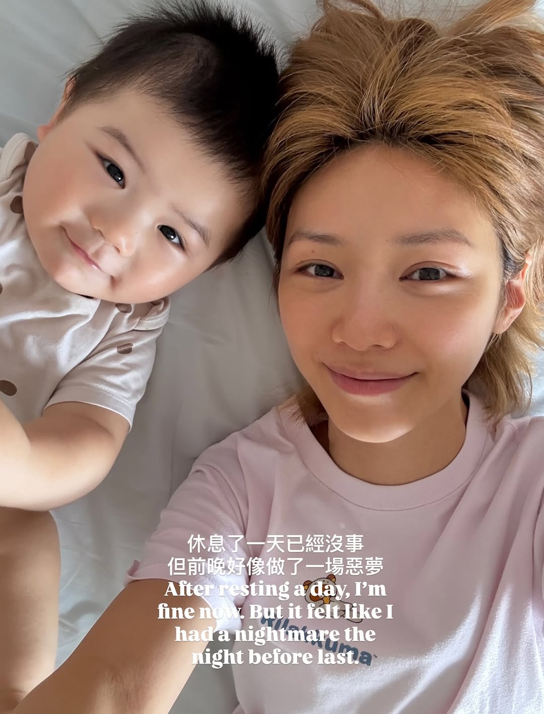 倪晨曦面膜液入眼劇痛入急症！眼科醫生：嚴重可致盲！8招緊急護理及預防
