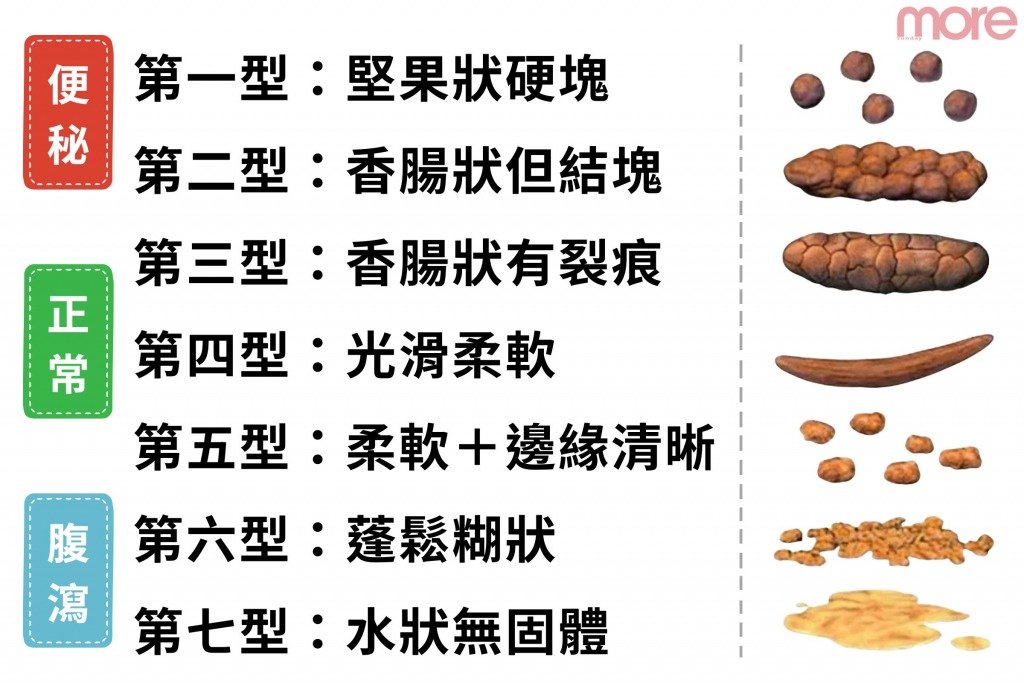 糞便顏色 (圖片來源:MORE製圖)