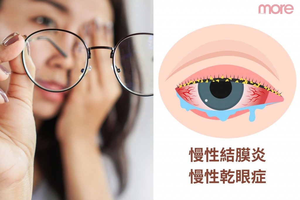 倪晨曦 (圖片來源:MORE製圖)