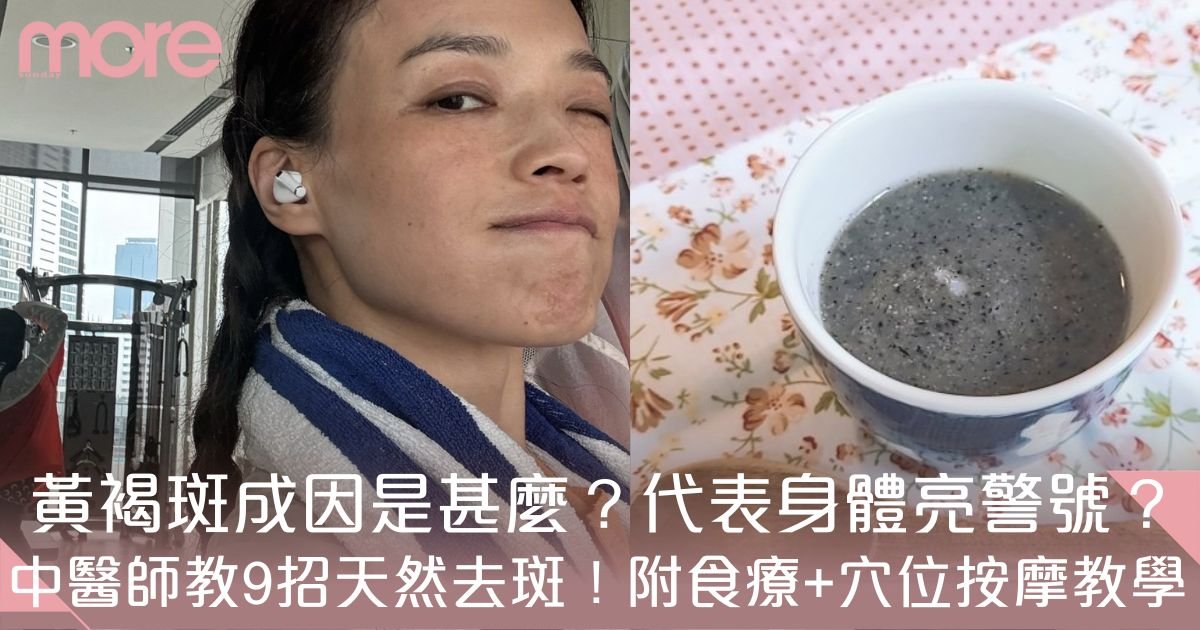 黃褐斑成因！中醫教9招淡斑＋穴位按摩 改善肝脾腎失調！
