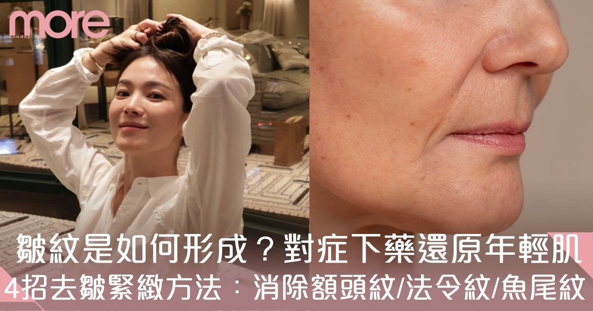 皺紋成因+消除方法：教你4招去皺緊緻：消除額頭紋/法令紋/魚尾紋/頸紋