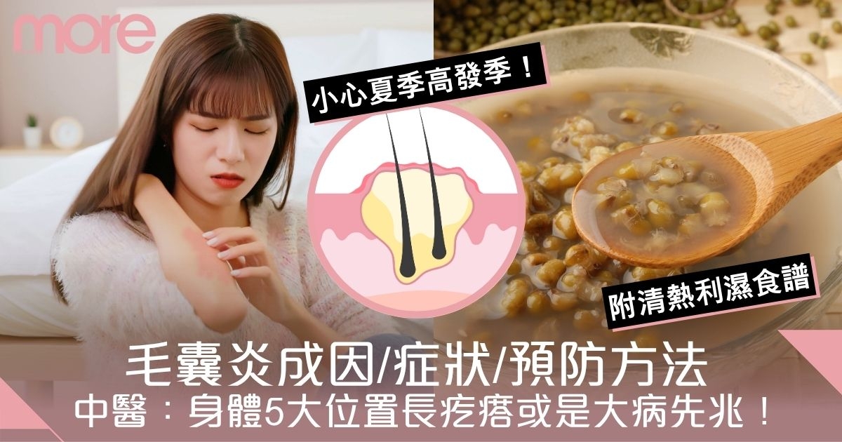 毛囊炎成因/症狀！中醫：身體5大位置長疙瘩或是大病先兆！附清熱利濕食譜