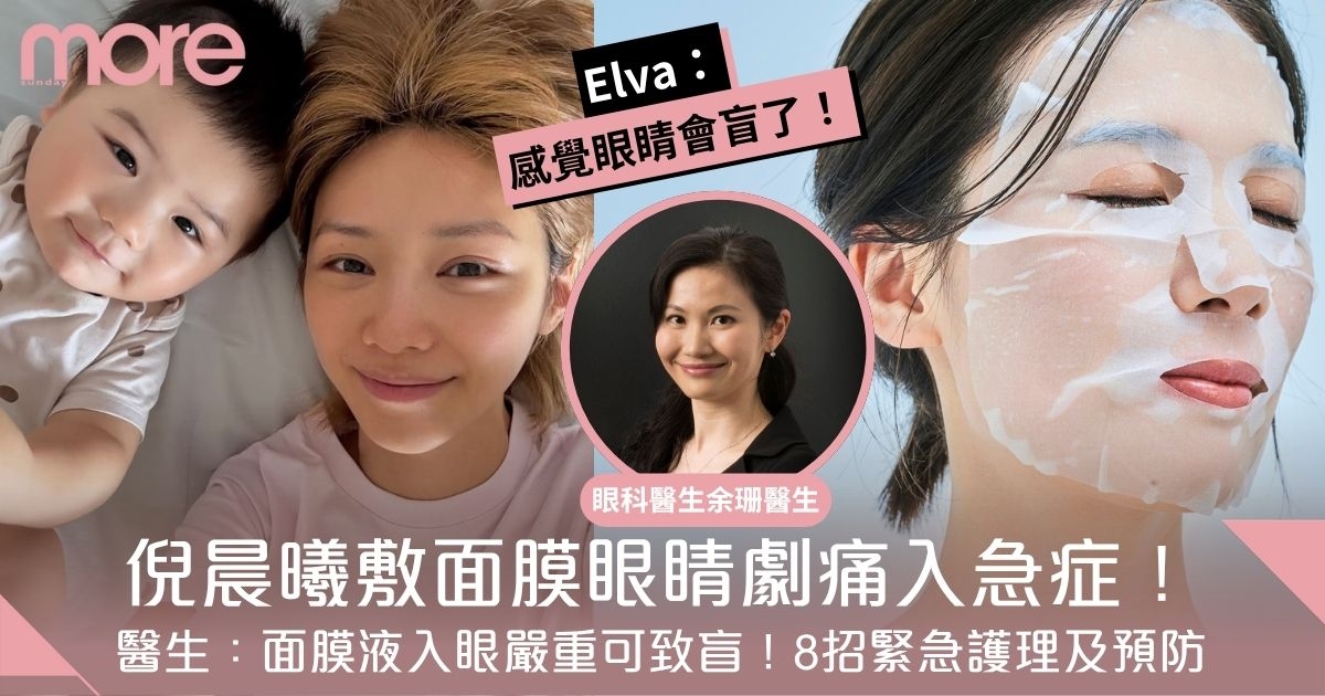 倪晨曦面膜液入眼劇痛入急症！眼科醫生：嚴重可致盲！8招緊急護理及預防