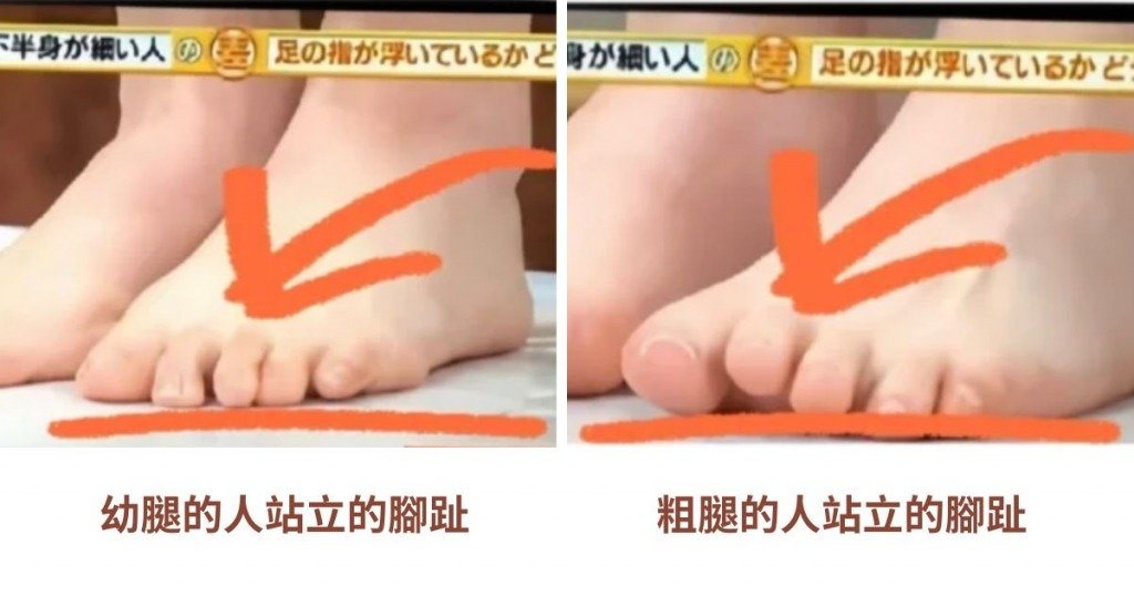 正確行路姿勢 長時間維持錯誤步姿引致的粗腿,腳趾無力,無法緊貼地面。(圖片來源:翻截自日本綜藝節目)
