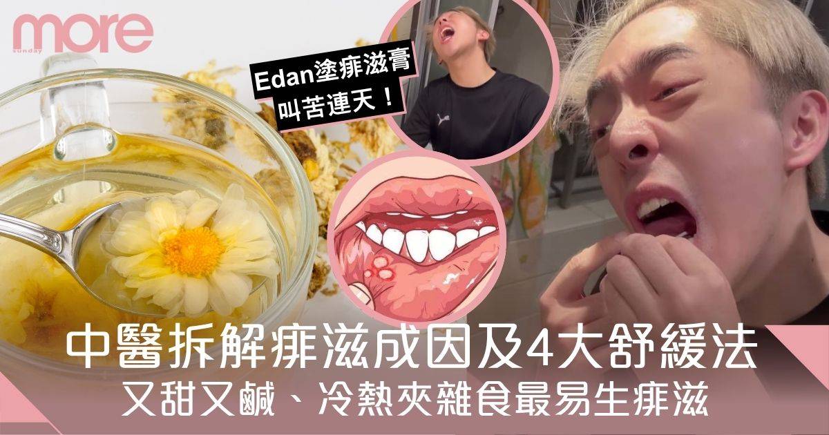 痱滋｜Edan塗痱滋膏叫苦連天！中醫拆解生痱滋成因及4大舒緩法、加快癒合