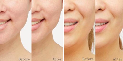 抗老先補膠原！擊退初老必備Caudalie人氣膠原精華 補足並激活3種膠原蛋白及微透明質酸 打造緊緻水潤彈滑肌