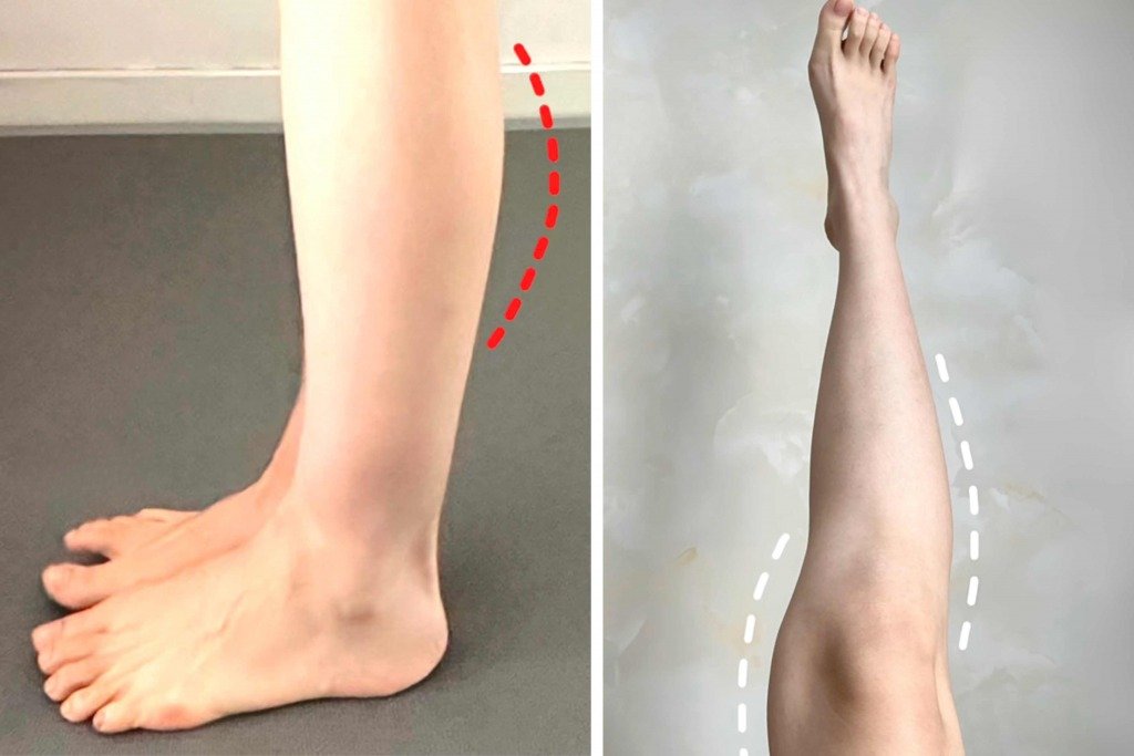 睡前瘦小腿運動 不少女生有小腿外翻困擾,看上去腿型又粗又短,原來可透過足弓訓練改善這些困擾。(圖片來源:RED@小涵在减脂)