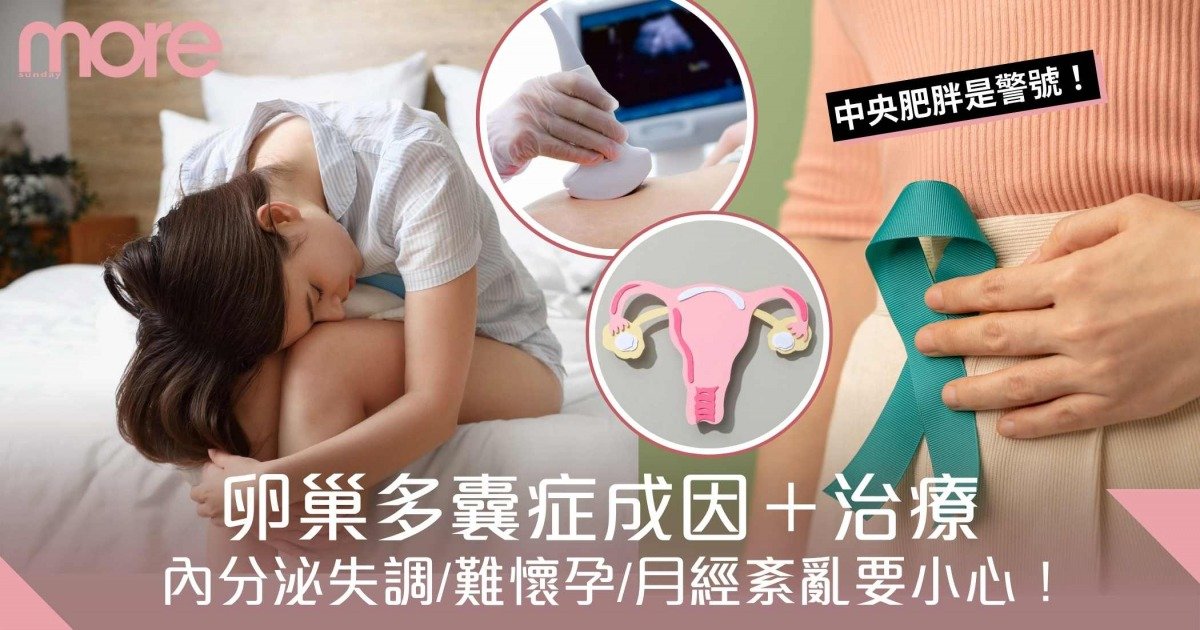 卵巢多囊症成因｜內分泌失調、懷孕不成、月經周期紊亂要小心！
