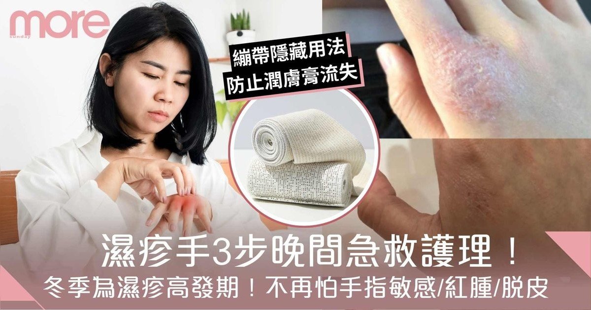 濕疹急救！濕疹手晚間3步護理！不再怕手指敏感/紅腫/脫皮