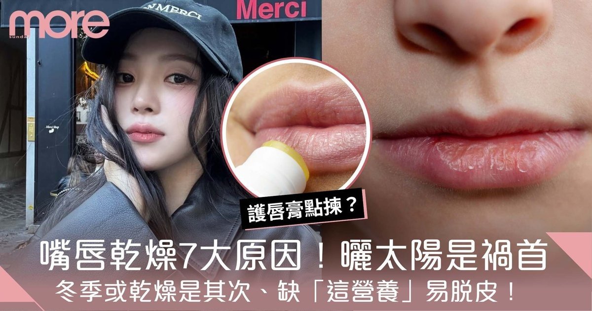 嘴唇乾燥原因：缺乏甚麼？喝水沒用怎麼辦？8大紓緩方法