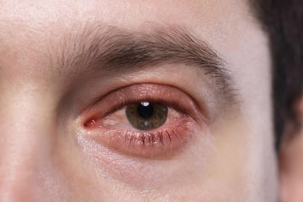 保持眼白亮白的 10 (圖片來源:Canva)