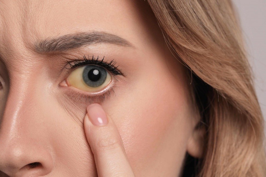 保持眼白亮白的 10 (圖片來源:Canva)