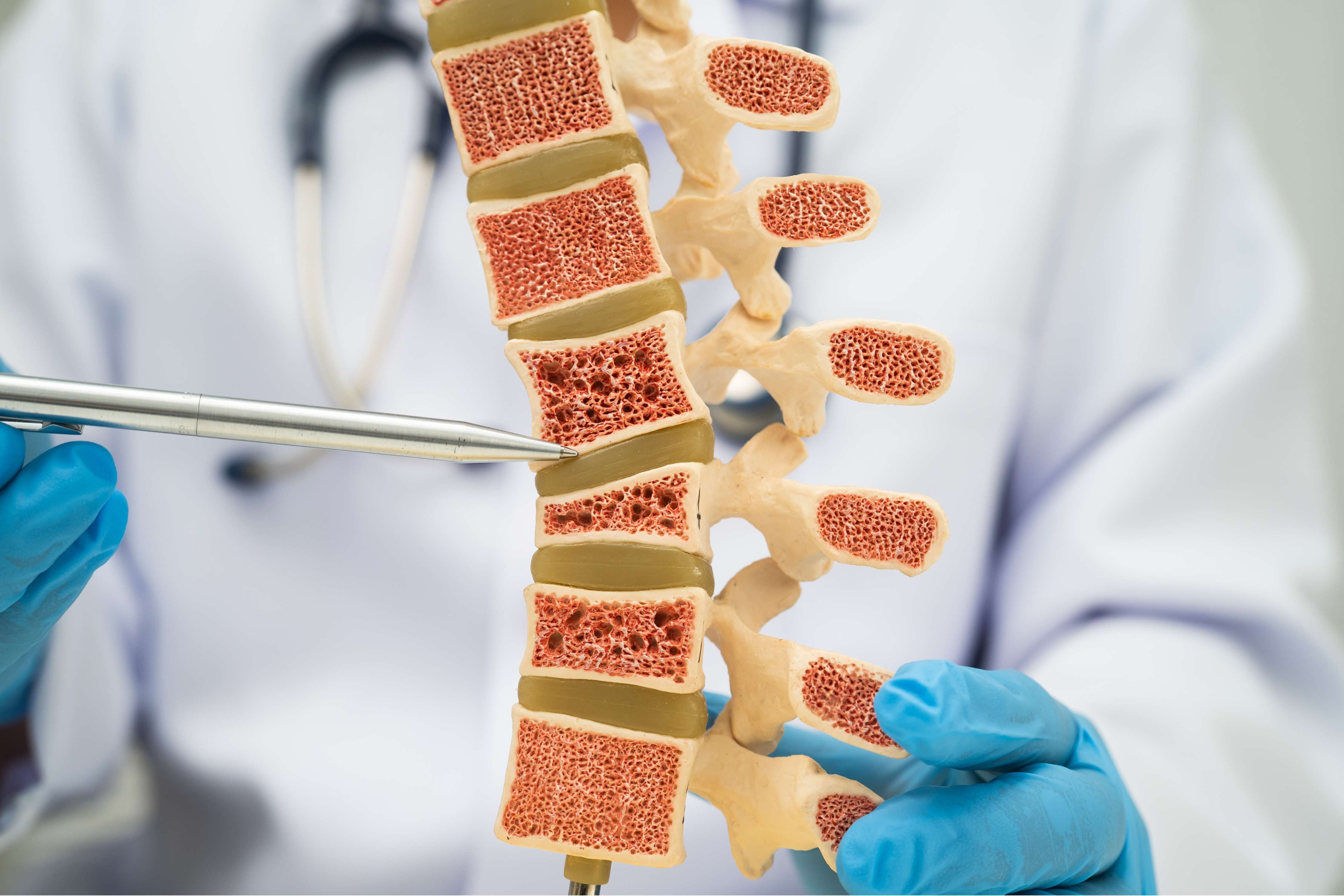 預防骨質疏鬆丨營養師推薦10款更年期必吃強骨食物　告別骨折風險