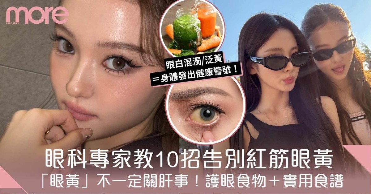 保持眼白亮白丨眼科專家教10個生活好習慣！告別紅筋眼黃