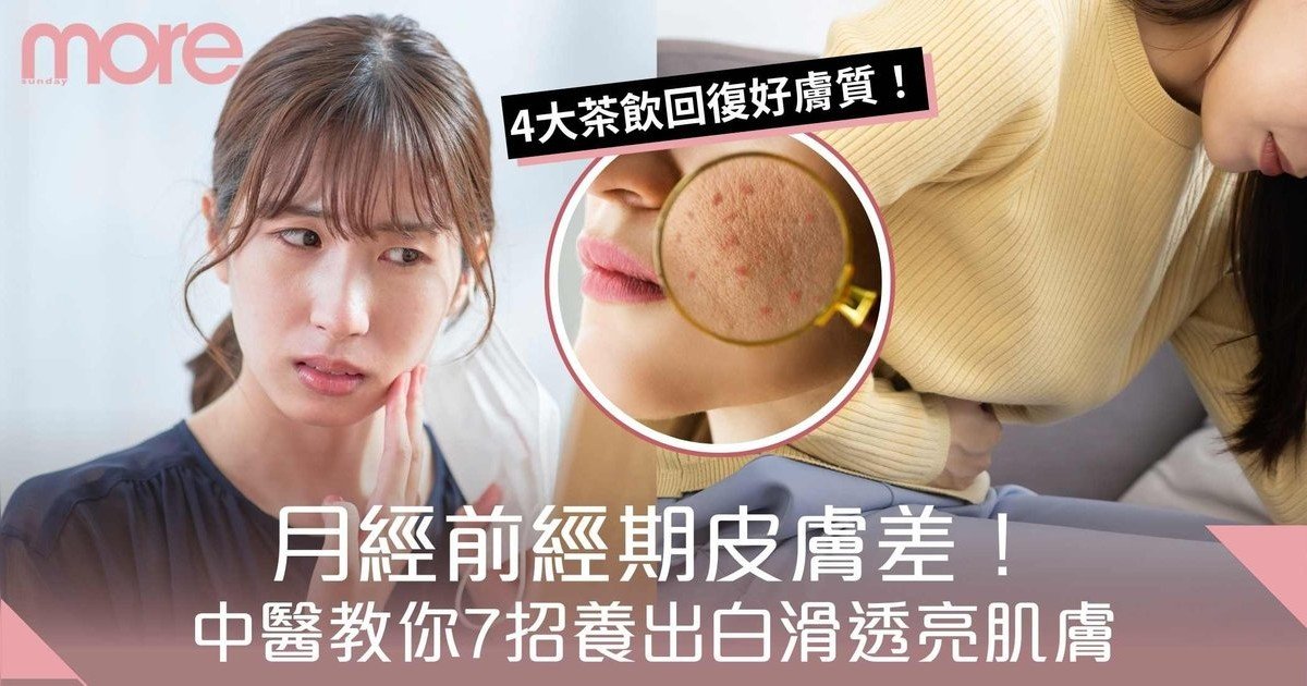 月經前經期皮膚差：粗糙暗沉、生暗瘡！中醫教你7招養出白滑透亮肌膚