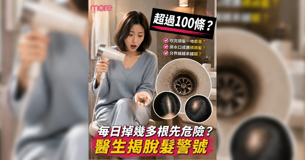 每日掉幾多頭髮先正常？醫生拆解脫髮原因＋8大防脫髮食物清單！附中醫養髮穴位