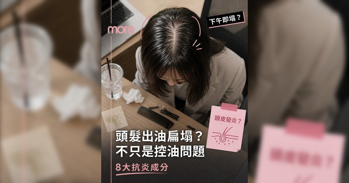 頭髮扁塌出油快？頭皮抗炎攻略！皮膚科醫生拆解8大控油成分告別頭油笠痴痴