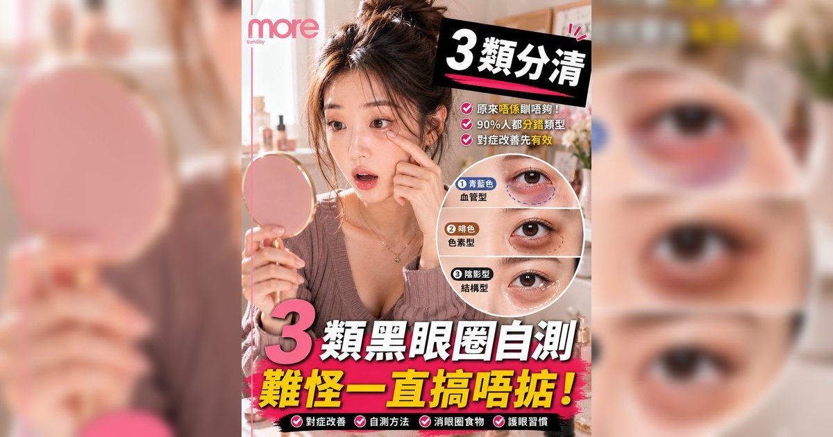 黑眼圈3類對症處理｜醫生教分血管色素結構型！15招KO萬年眼圈附眼霜成分推薦