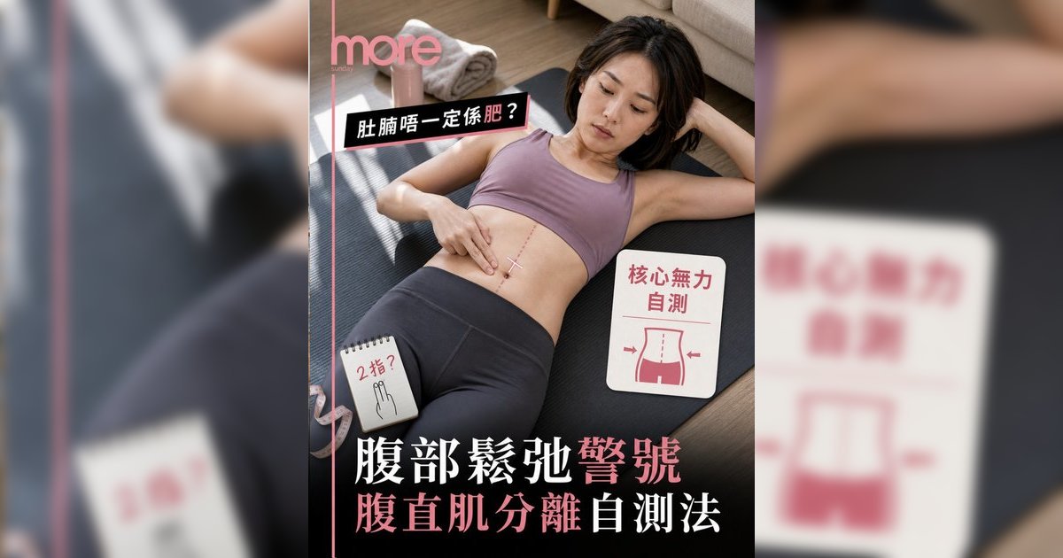 腹部鬆弛不是肚腩？物理治療師教5步自測腹直肌分離 附核心改善運動懶人包