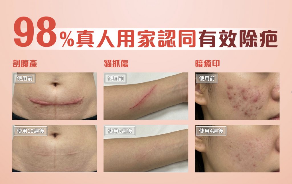 想擁有韓星同款零瑕疵肌膚 唔一定靠醫美! (圖片來源:3ChemBio)